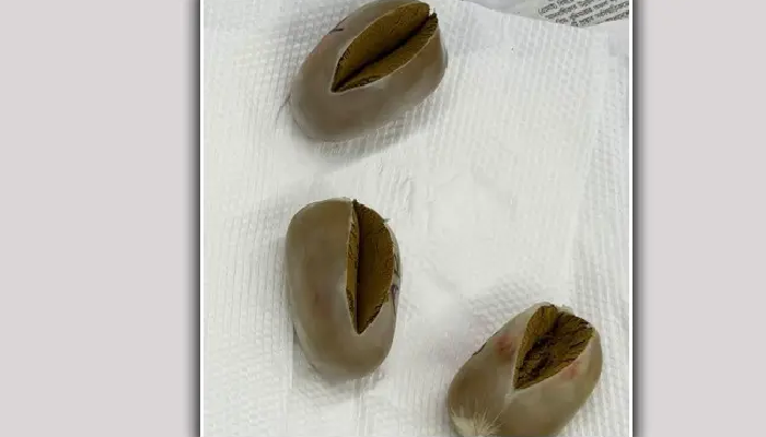 শাহজালালে যাত্রীর পায়ুপথে মিললো ৩ সোনার ডিম
