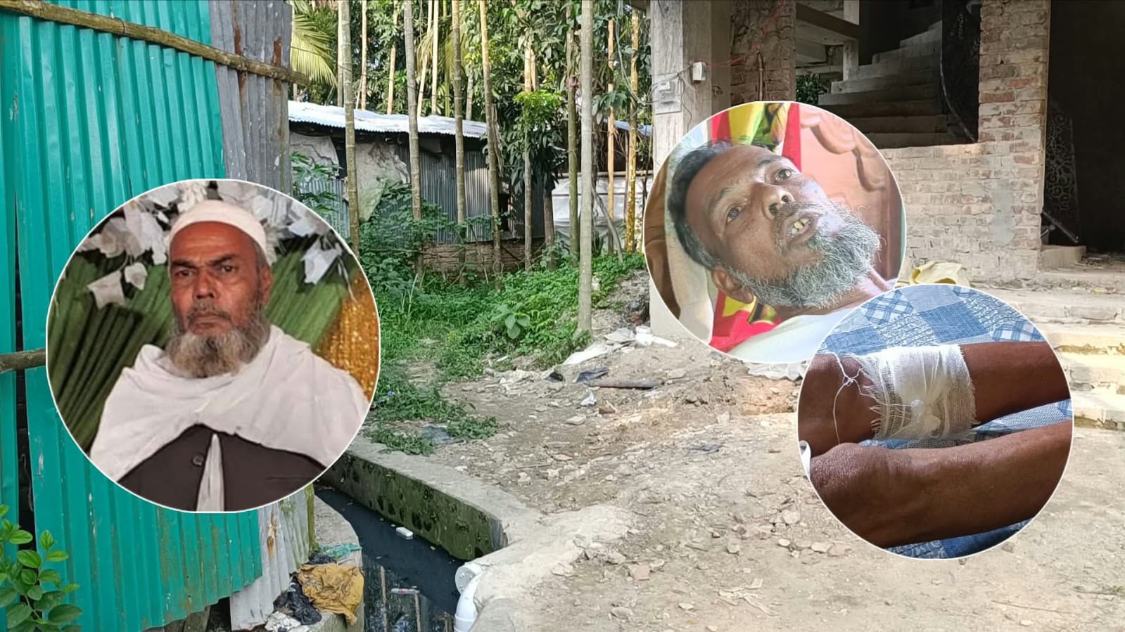 সালিশী বৈঠকে ডেকে ছোট ভাইকে জখম করার অভিযোগ বড় ভাইয়ের বিরুদ্ধে