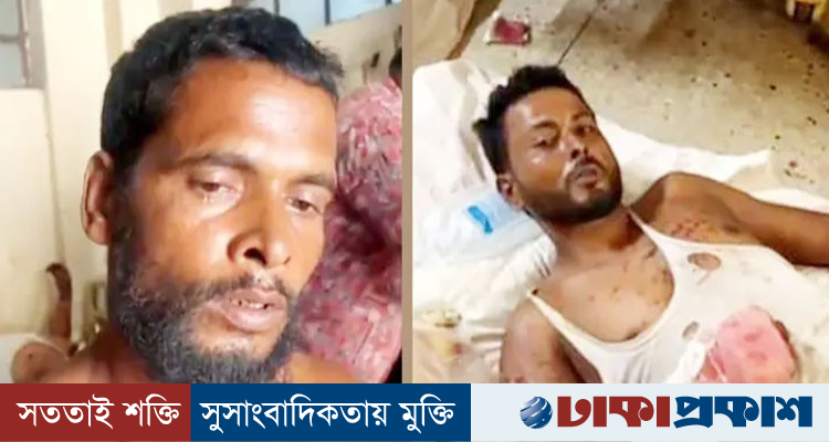 বাংলাদেশি ভেবে ভারতীয় দুই নাগরিককে গুলি, বিএসএফের গুলিতে আহত হয়ে বাংলাদেশে